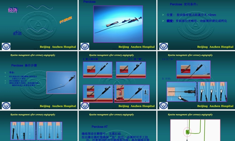 5-冠脉造影术后常规处理.pptx