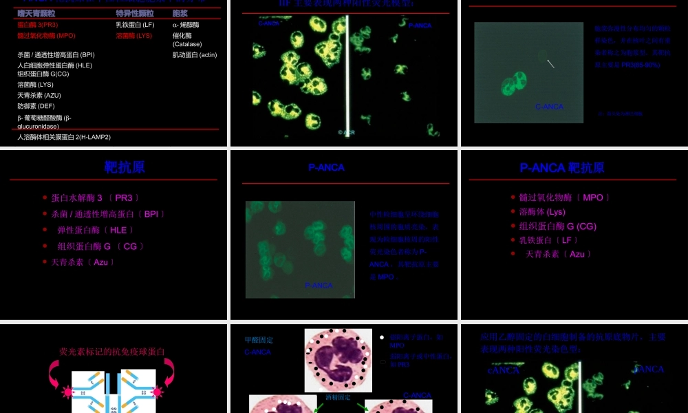 ANCA相关小血管炎0-(AAV)amx2.pptx