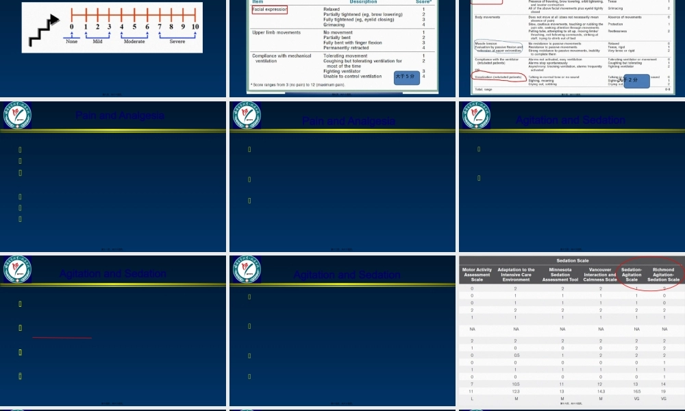 ICU镇痛镇静iPAD指南.pptx