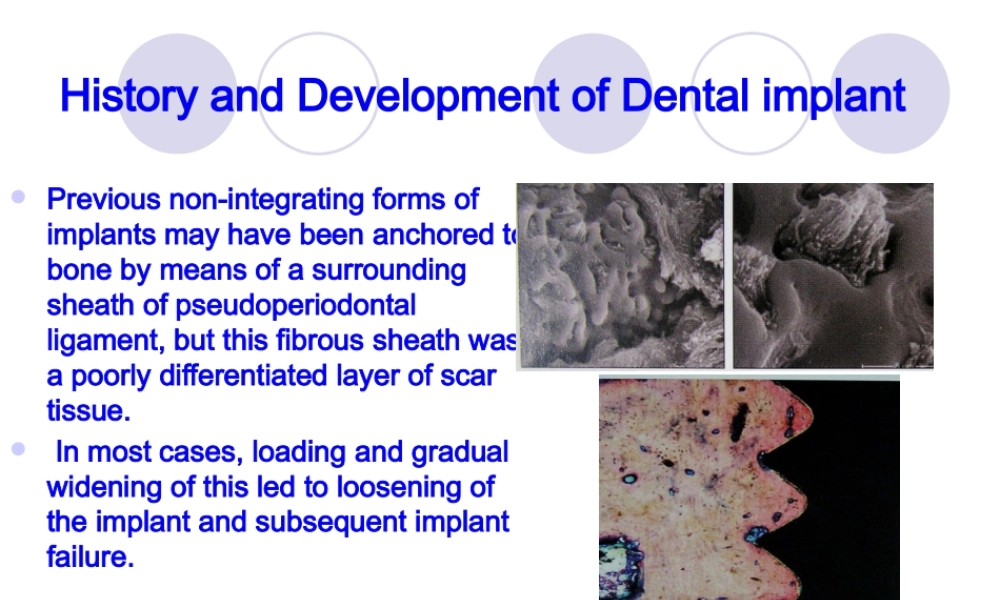 implant-history-and-development-口腔种植.pptx