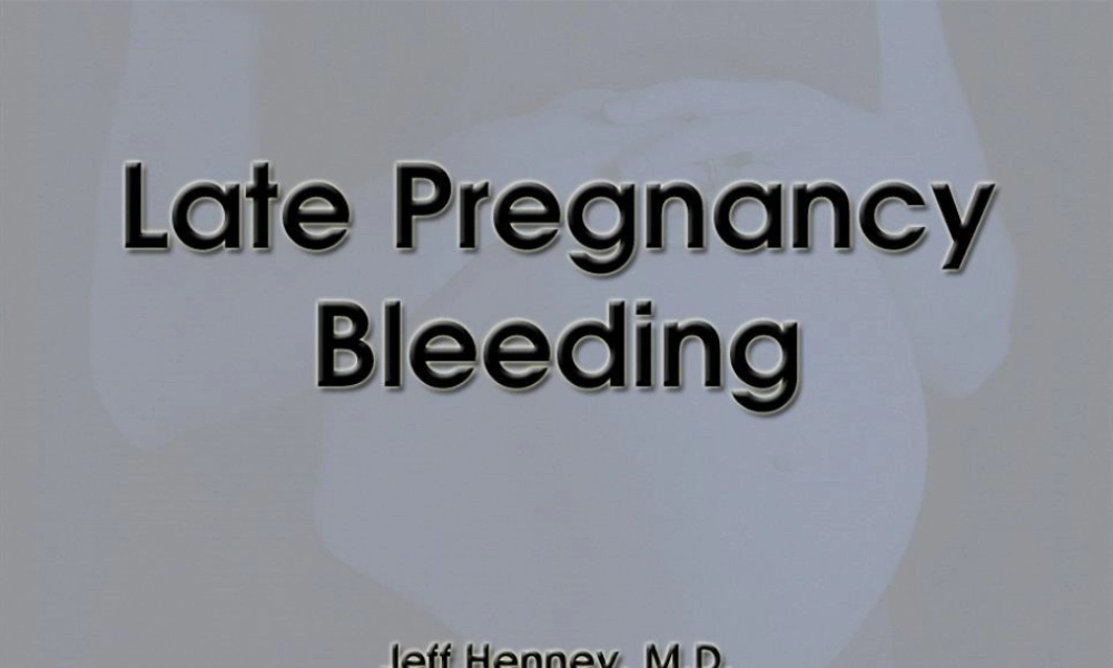 LatePregnancyBleeding晚期妊娠流血.pptx