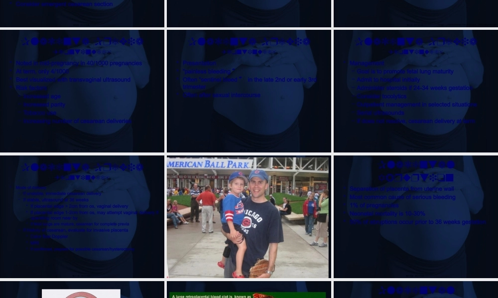 LatePregnancyBleeding晚期妊娠流血.pptx