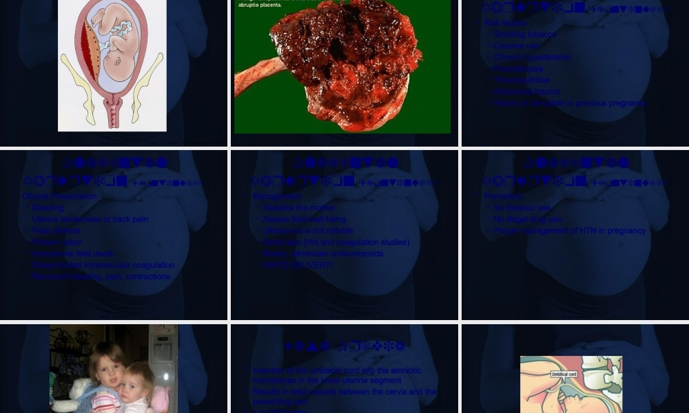 LatePregnancyBleeding晚期妊娠流血.pptx