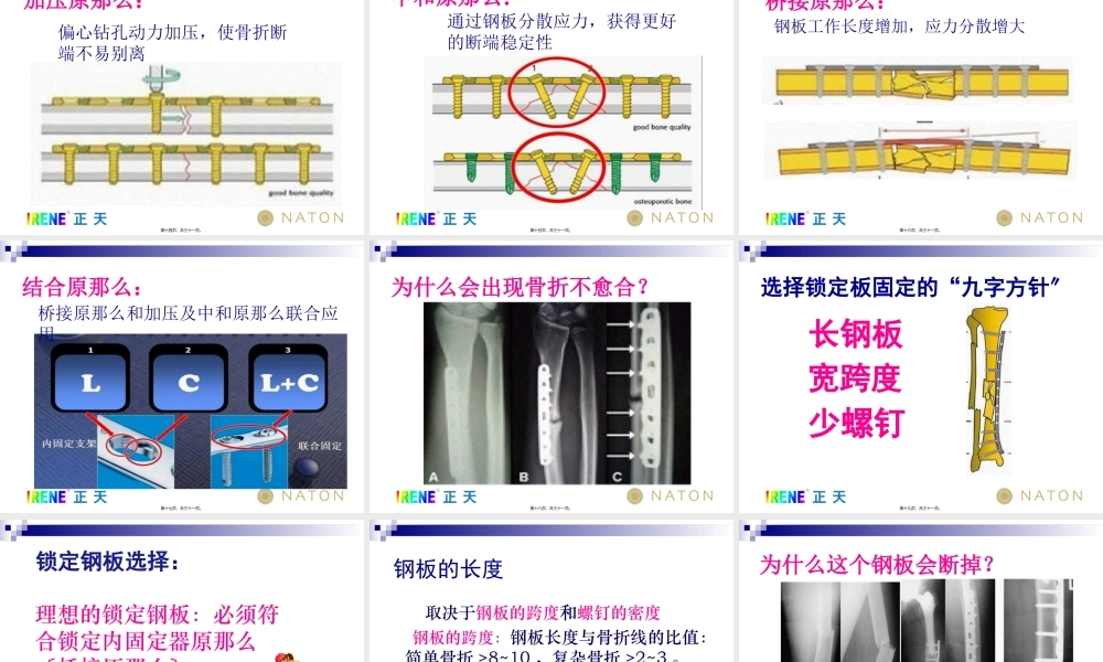 LCP系统接骨板的注意问题及常见问题(免金币).pptx