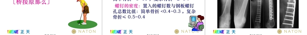 LCP系统接骨板的注意问题及常见问题(免金币).pptx