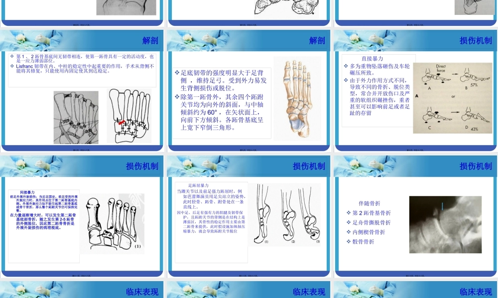 Lisfranc-损伤.pptx