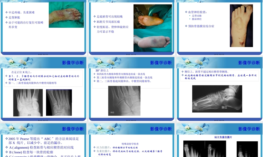 Lisfranc-损伤.pptx