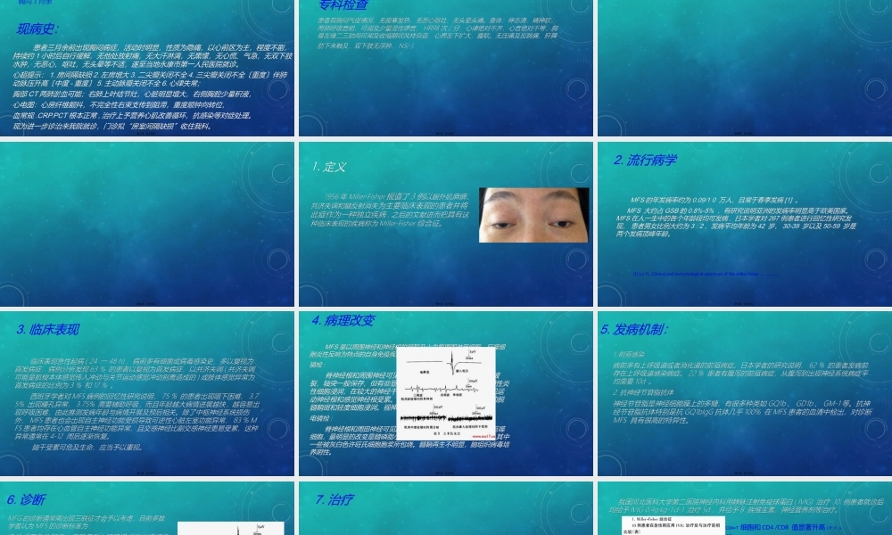 Miller-Fisher综合症.ppt
