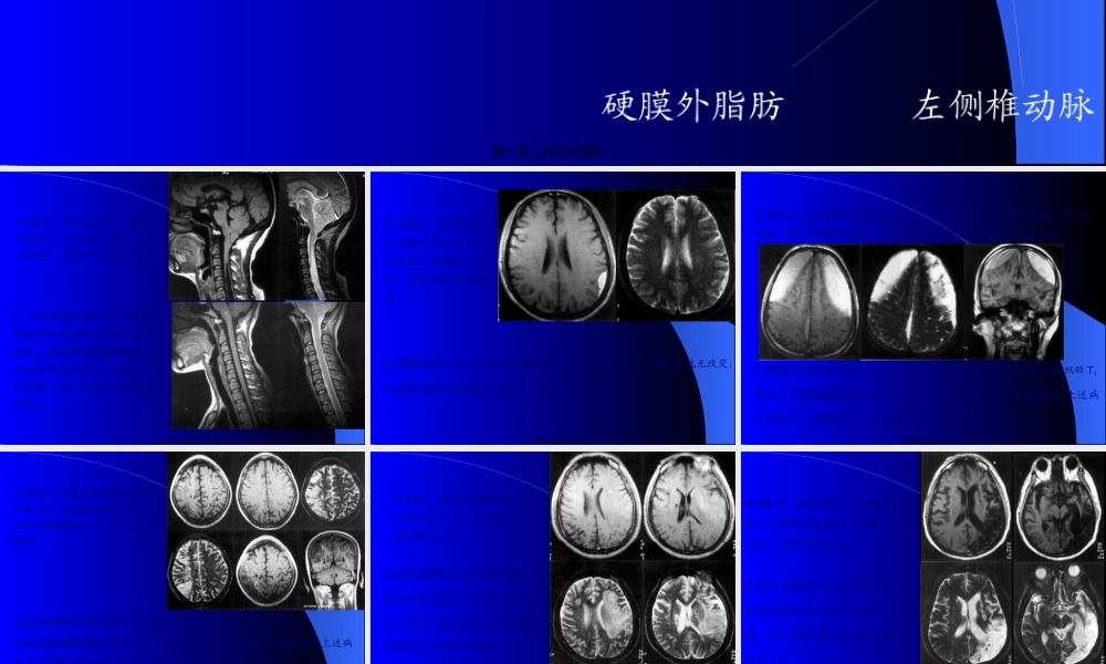 MRI图像-脑-01.pptx