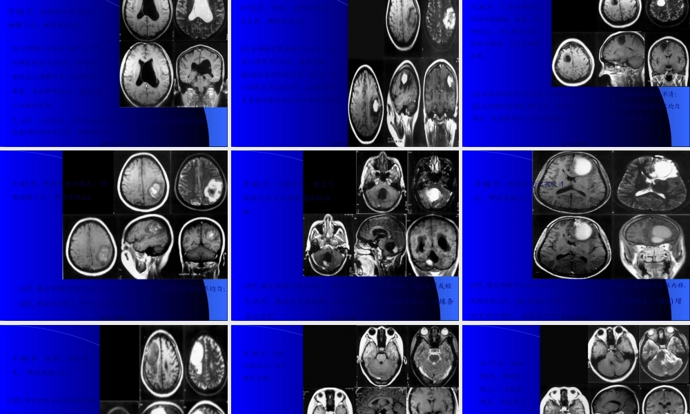 MRI图像-脑-01.pptx