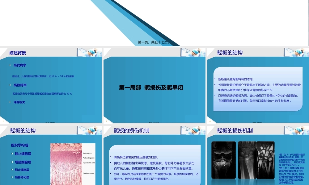 MRI检查在骨骺损伤090518.pptx