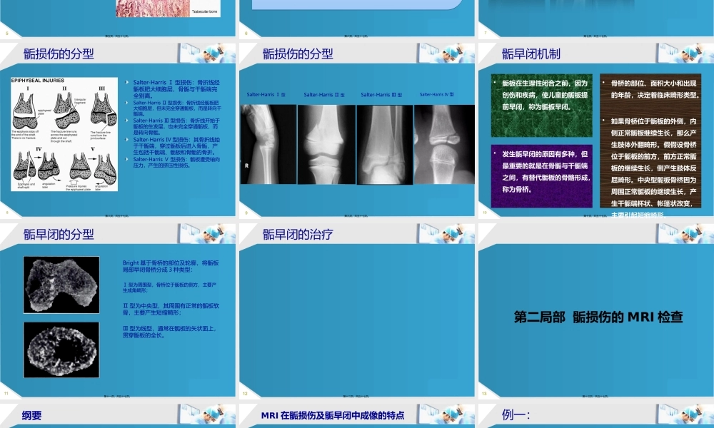 MRI检查在骨骺损伤090518.pptx