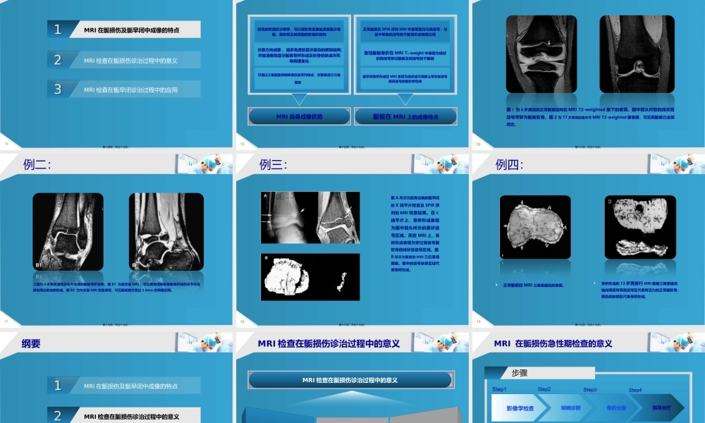 MRI检查在骨骺损伤090518.pptx