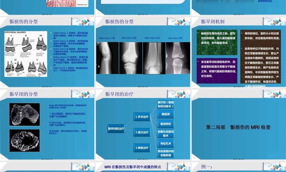 MRI检查在骨骺损伤.pptx