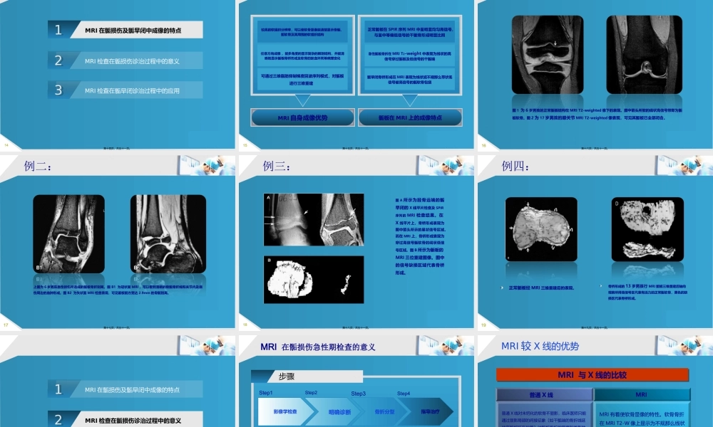 MRI检查在骨骺损伤.pptx