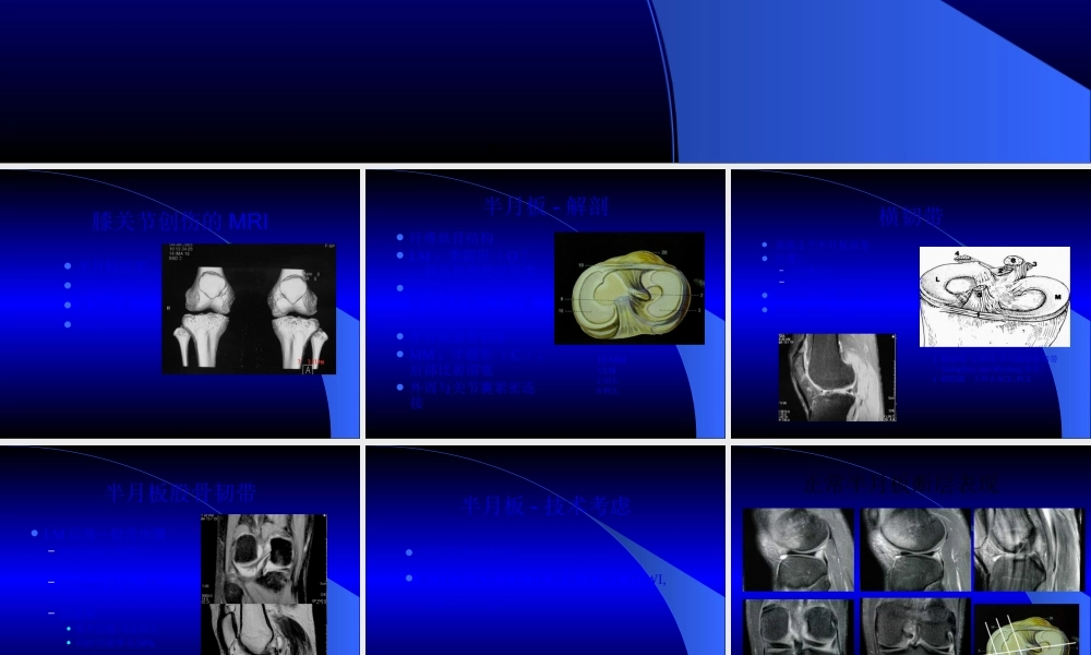 MRI膝关节.pptx