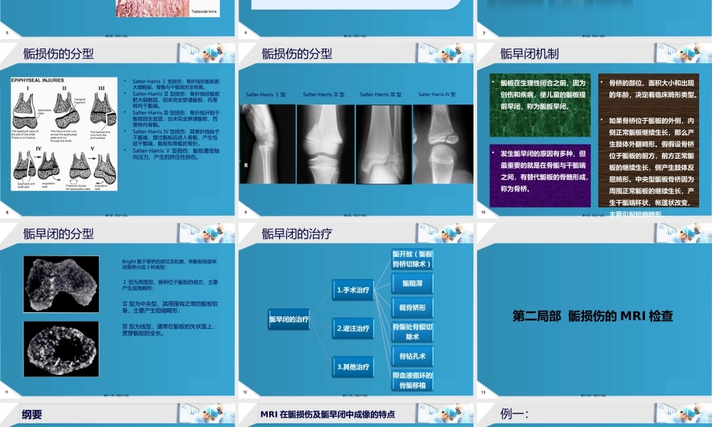 MRI检查在骨骺损伤中的应用研究与进展.pptx