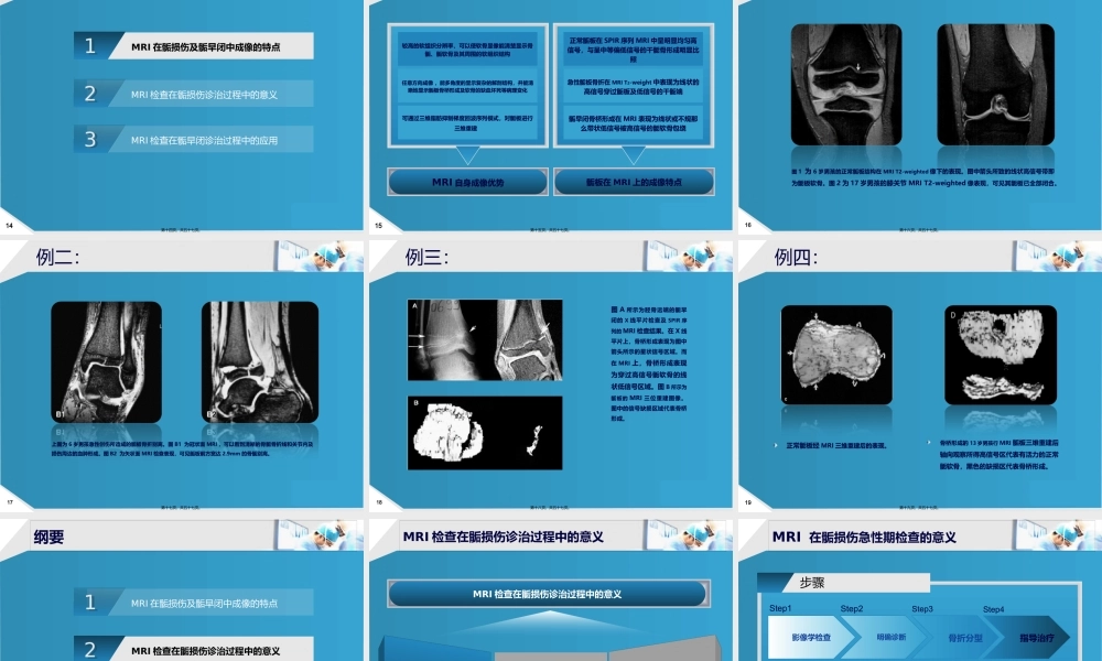 MRI检查在骨骺损伤中的应用研究与进展.pptx