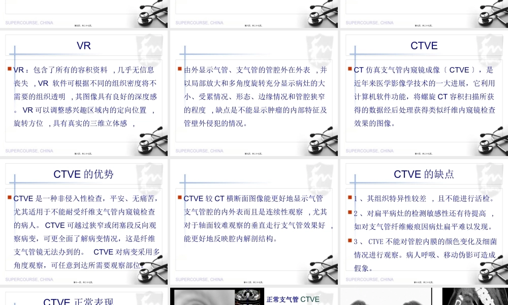 MSCT图像后处理技术对中央型肺癌气管、支气管树的应用.pptx