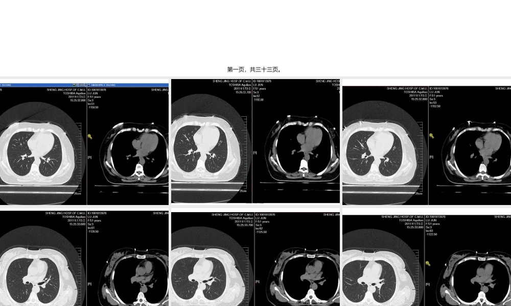 NCCN肺癌筛查指南2012版.pptx