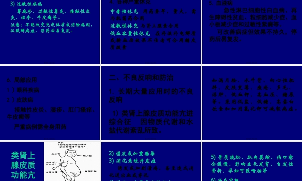 new-合理用药糖皮质激素.pptx