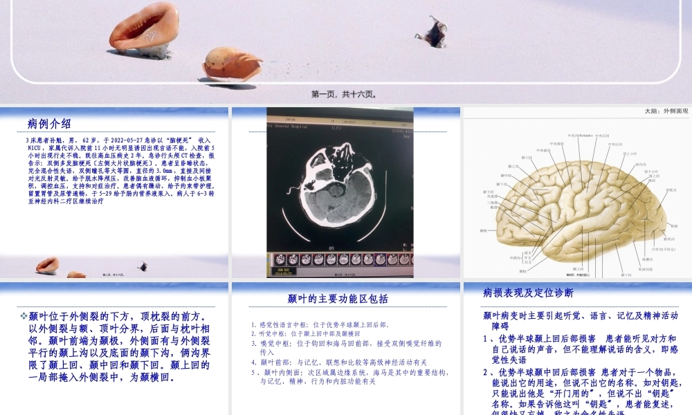 NICU脑梗塞.pptx