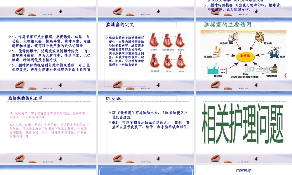 NICU脑梗塞.pptx