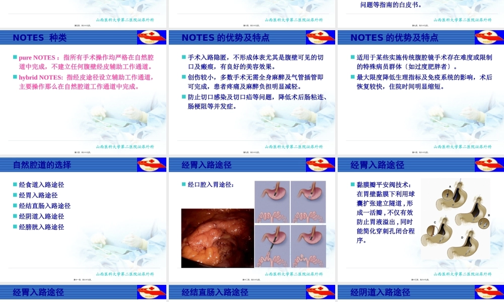 NOTES经自然腔道内镜手术.pptx