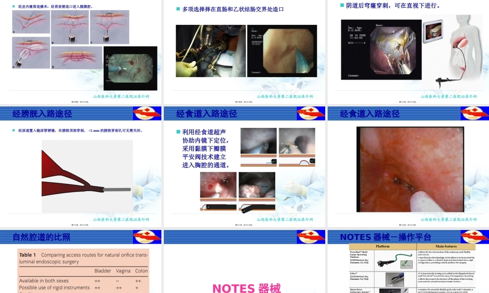 NOTES经自然腔道内镜手术.pptx