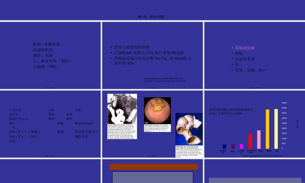 NSAID与胃肠道损伤.pptx