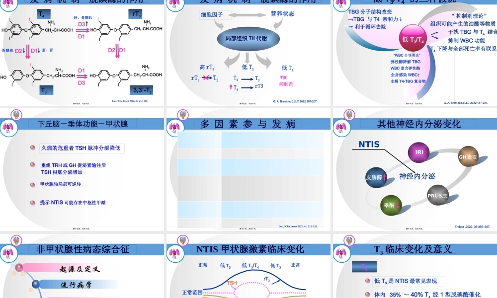 NTIS-甲状腺功能正常病态综合征.pptx