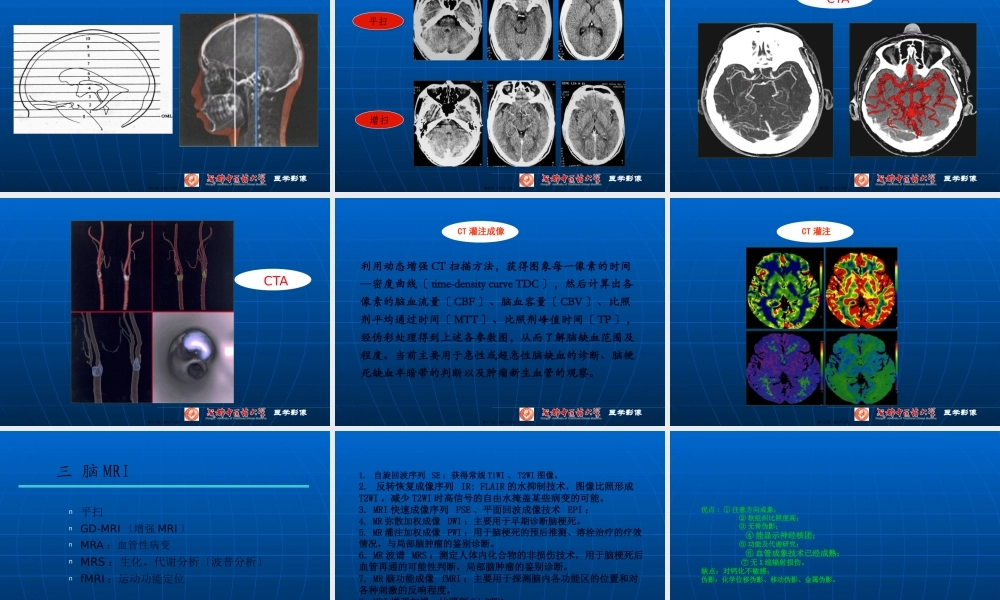 NS检查、正常、基本病变CT与MRI.pptx