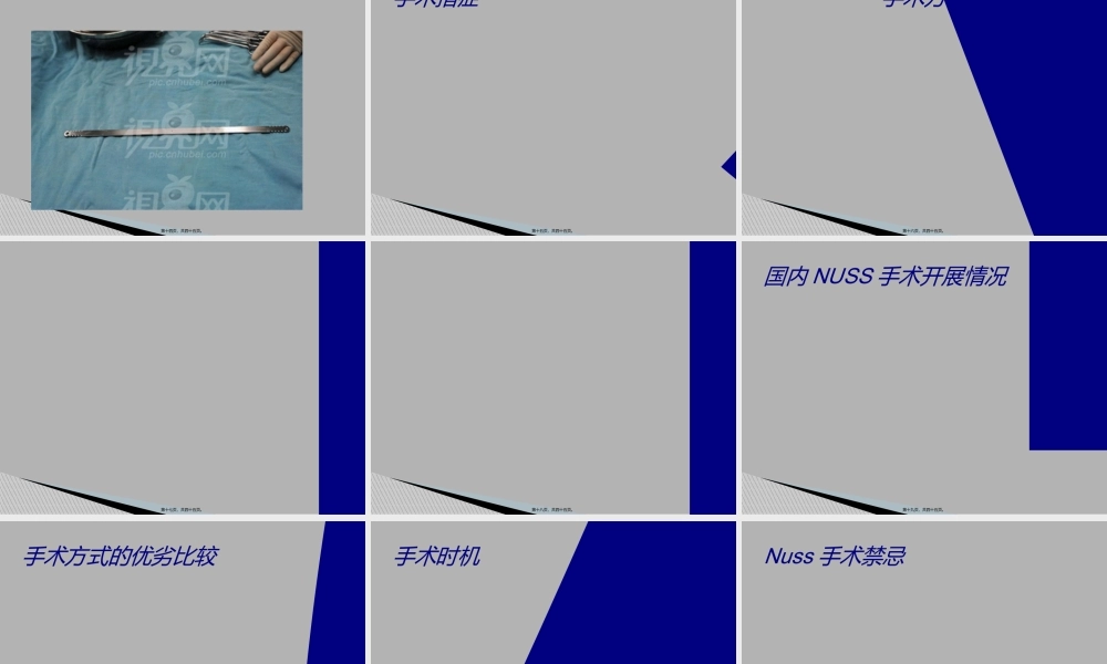 NUSS手术.ppt