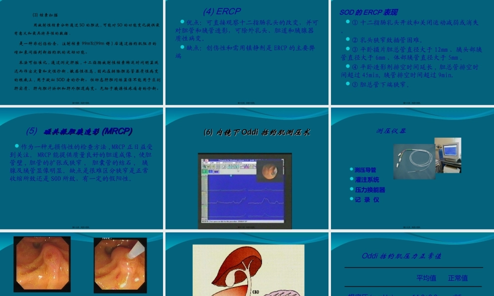 Oddi括约肌运动功能障碍.ppt