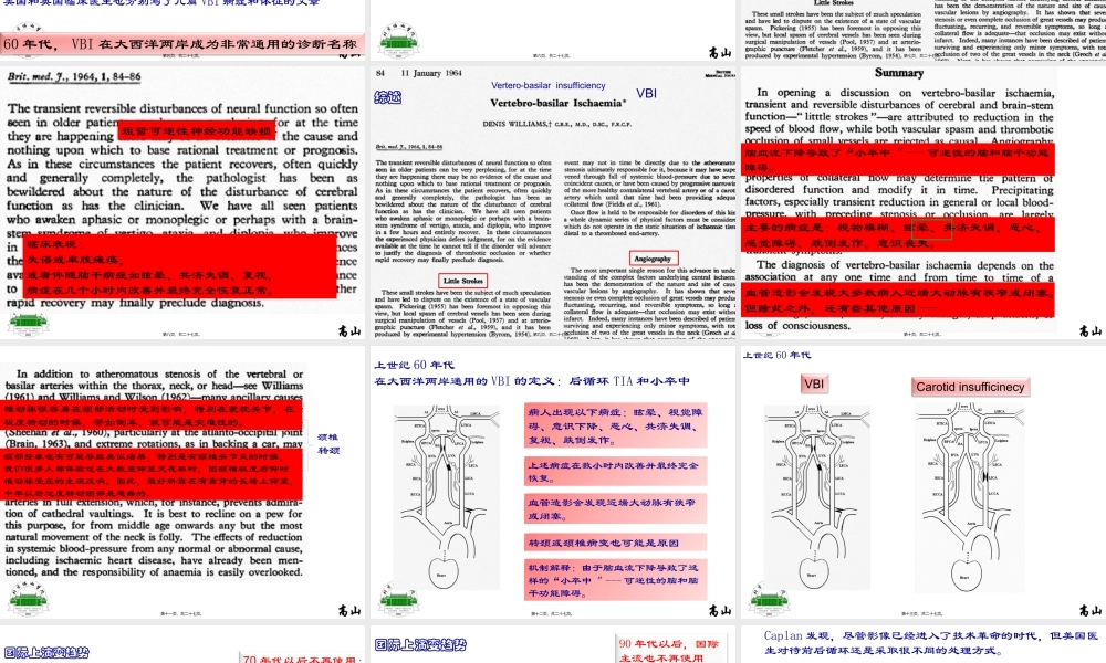 PCI(后循环缺血)和VBI(椎基底动脉供血不足)的前世和今生.pptx