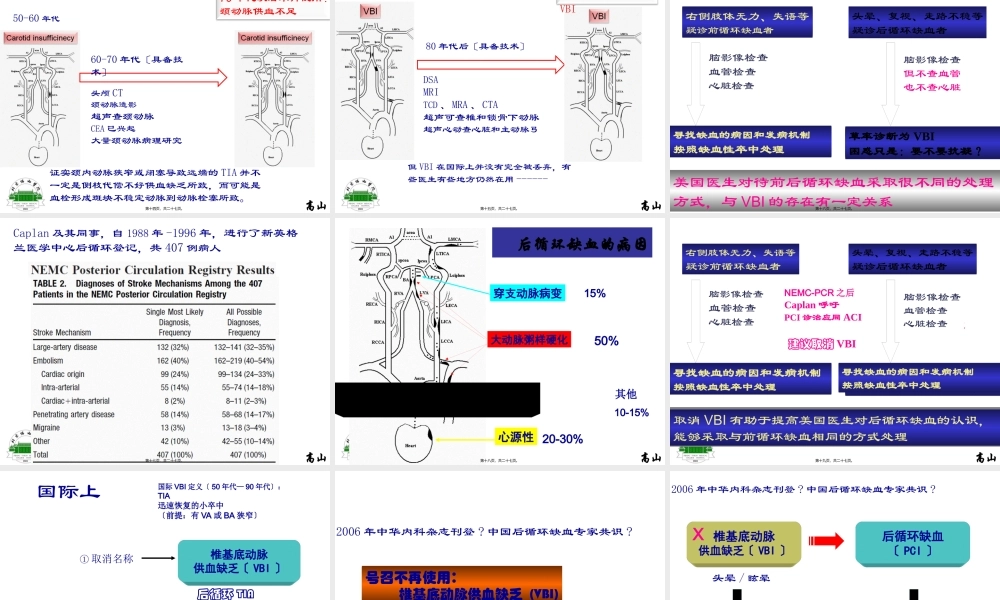 PCI(后循环缺血)和VBI(椎基底动脉供血不足)的前世和今生.pptx