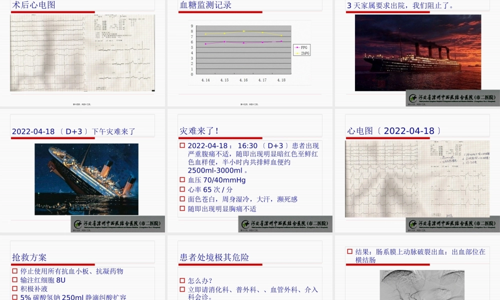 PCI术后合并肠系膜动脉破裂失血性休克一例.pptx