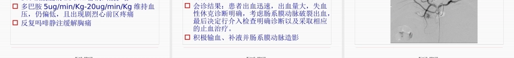 PCI术后合并肠系膜动脉破裂失血性休克一例.pptx