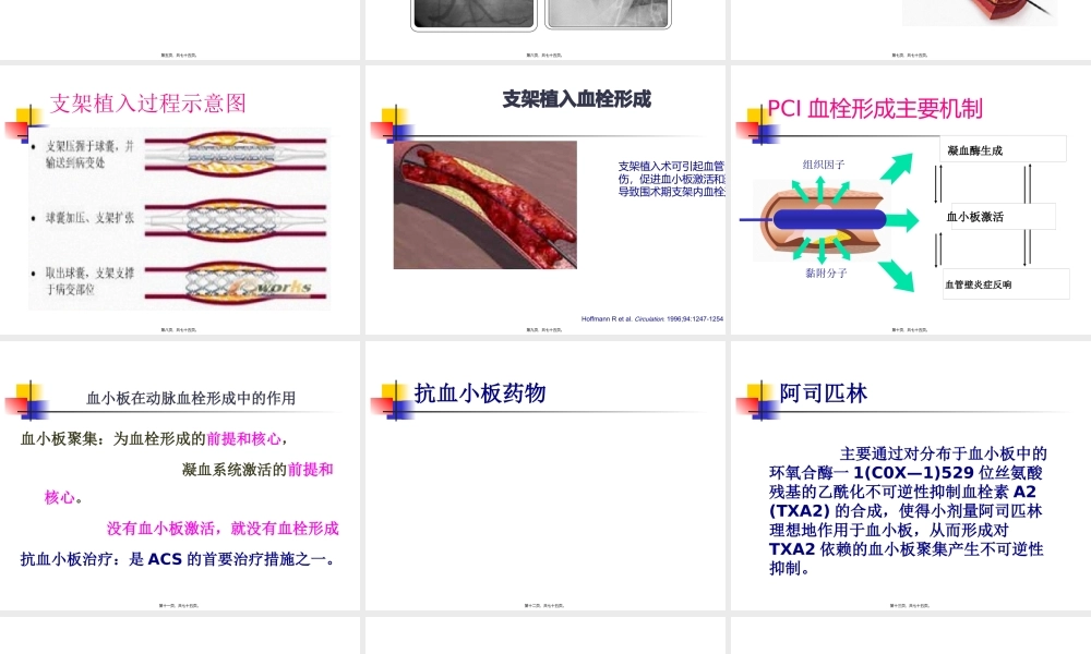 PCI术前、术中和术后.pptx