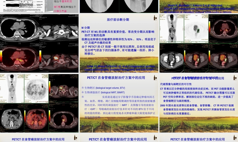 PET-CT在食管癌放疗中的进展.pptx