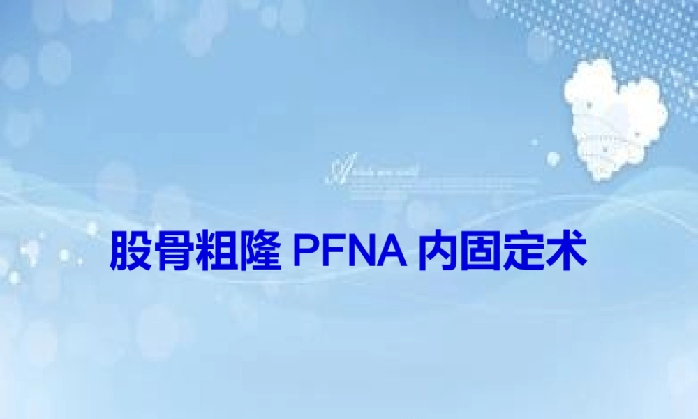 PFNA内固定术汇总.pptx