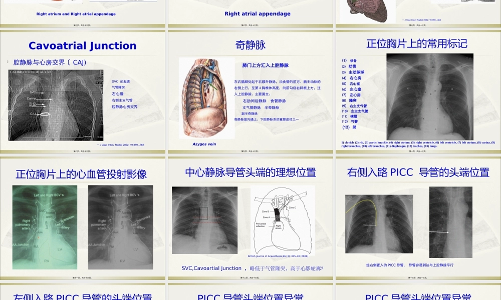PICC导管头端定位与并发症处理.pptx