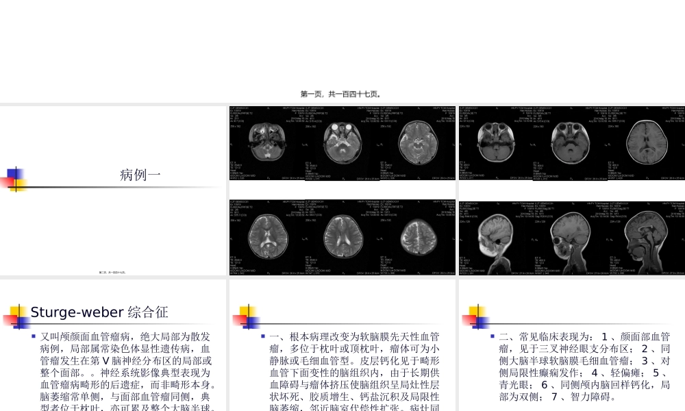MRI颅脑典型病例.pptx