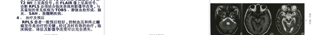 MRI颅脑典型病例.pptx