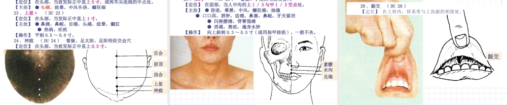 90人体经络穴位图谱13督脉(1).ppt