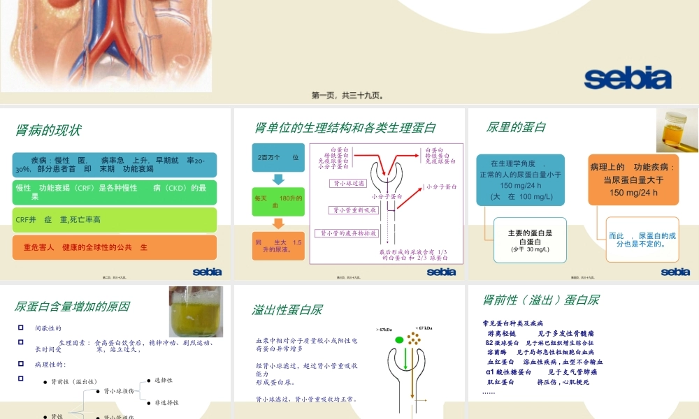 SDS尿蛋白及本周氏电泳的意义.ppt