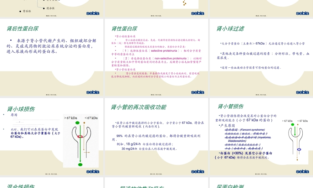 SDS尿蛋白及本周氏电泳的意义.ppt