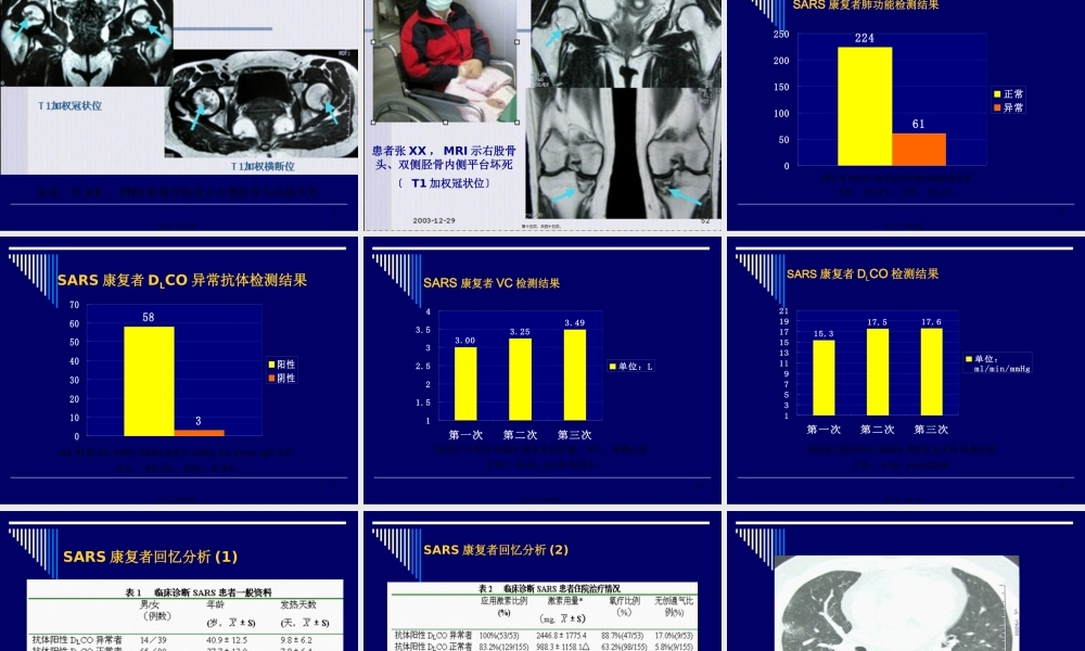 SARS康复期患者长期随诊的意义.pptx