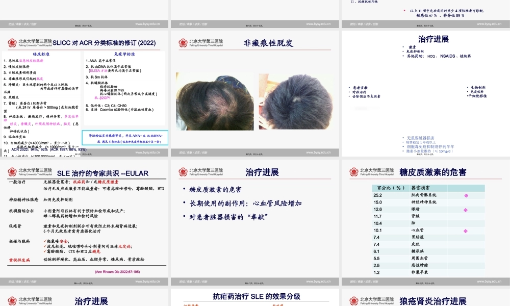 SLE诊治进展.pptx