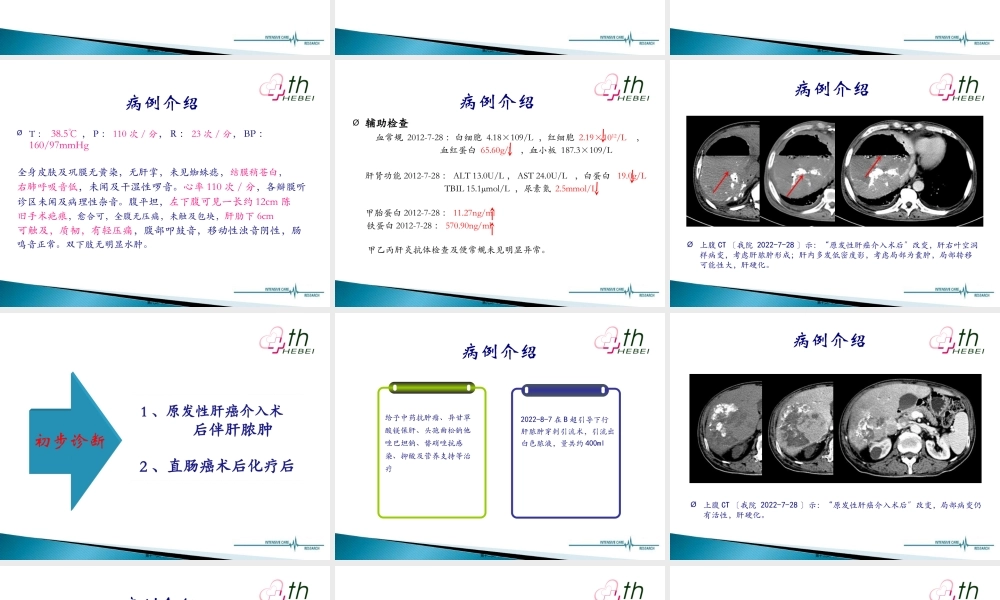 TACE术后并发肝脓肿.pptx